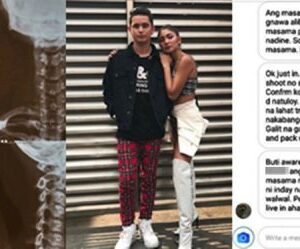 Nadine Lustre’s X-Ray Result Ignites Speculations Following JaDine Movie Shoot Pack-Up