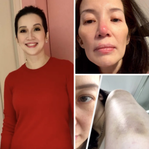 JUST IN! Kris Aquino Has a Message and Shows Her Latest Status for Fans!