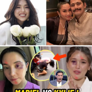 Kylie Padilla Slaps Mariel Rodriguez After Cheating Her Father Robin Padilla! (VIDEO)