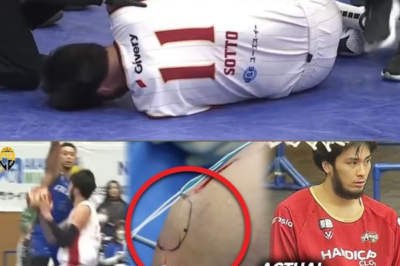 Ganito GINAWA ANG nakakatakot na pinsala ni KAI SOTTO! Kailan babalik pagkatapos ng pinsala sa ACL?