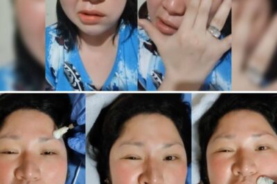 Frenchie Dy shares the struggles she faced as she underwent treatment after her facial paralysis …