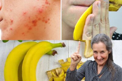 I Rubbed Banana Peel on My Face & My Pimples Are Gone – The Power of the Banana Face Mask(DG)