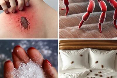 Bed Bug: Paano sila nabubuhay? Paano mapupuksa ang mga ito sa iyong tahanan..sa isang simpleng pamamaraan ay madali mong mapupuksa ang mga ito … recipe sa ibaba sa mga komento👇👇 /lo