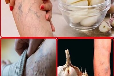 Ancient Garlic Remedy for Pain Relief: A Secret Passed Down from Generations