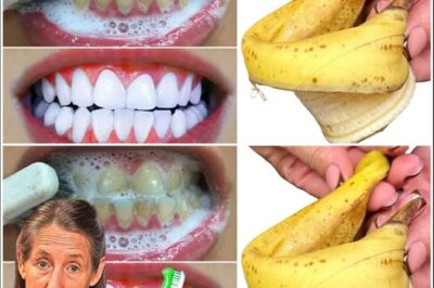 Achieve a Pearly White Smile in Just 1 Minute: The Ultimate Teeth Whitening Hack!