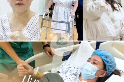 Angelica Panganiban details surgery for avascular necrosis