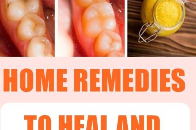 Herbal Secrets to Naturally Heal Cavities & Strengthen Your Teeth!